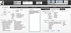 Observation window in GEOARCHrec